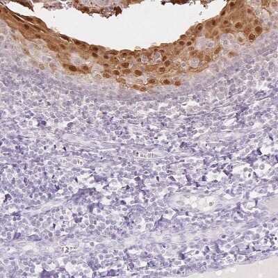 Immunohistochemistry-Paraffin SPRR3 Antibody