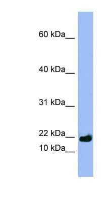 Western Blot: SPRR3 Antibody [NBP1-57647] - NCI-H226 cell lysate, concentration 0.2-1 ug/ml.