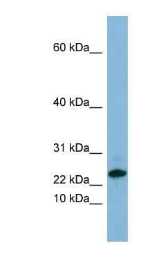 Western Blot: SPRR3 Antibody [NBP1-57679] - HT1080 cell lysate, concentration 0.2-1 ug/ml.
