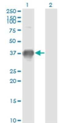 Western Blot: SPRY1 Antibody (2F1) [H00010252-M02] - Analysis of SPRY1 expression in transfected 293T cell line by SPRY1 monoclonal antibody (M02), clone 2F1.Lane 1: SPRY1 transfected lysate(35.1 KDa).Lane 2: Non-transfected lysate.