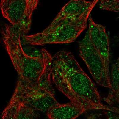 Immunocytochemistry/Immunofluorescence: SPRY1 Antibody [NBP2-57267] - Staining of human cell line Hep G2 shows localization to nucleoplasm, cytosol & the Golgi apparatus.