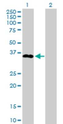 Western Blot: SPRY1 Antibody [H00010252-D01P] - Analysis of SPRY1 expression in transfected 293T cell line by SPRY1 polyclonal antibody.Lane 1: SPRY1 transfected lysate(35.10 KDa).Lane 2: Non-transfected lysate.