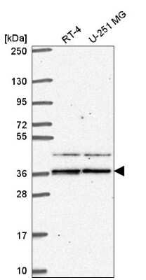 Western Blot: SPRY1 Antibody [NBP2-57267] - Western blot analysis in human cell line RT-4 and human cell line U-251 MG.