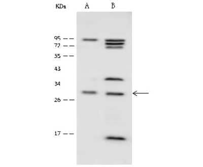 Western Blot: SPRY1 Antibody [NBP2-99516] - Anti-SPRY1 rabbit polyclonal antibody at 1:500 dilution. Lane A: HepG2 Whole Cell Lysate Lane B: HeLa Whole Cell Lysate Lysates/proteins at 30 ug per lane. Secondary Goat Anti-Rabbit IgG (H+L)/HRP at 1/10000 dilution. Developed using the ECL technique. Performed under reducing conditions. Predicted band size: 35 kDa