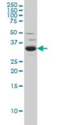 Western Blot: SPRY2 Antibody (1e10) [H00010253-M01] - SPRY2 monoclonal antibody (M01), clone 1E10 Analysis of SPRY2 expression in C32.