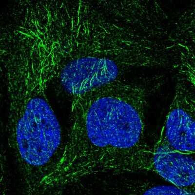 Immunocytochemistry/Immunofluorescence: SPRY2 Antibody [NBP2-59001] - Staining of human cell line CACO-2 shows localization to microtubules.