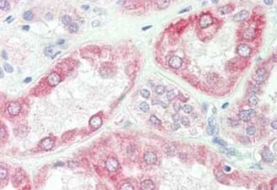 Immunohistochemistry: SPRY2 Antibody [NBP2-13158] - Tissue: kidney. Fixation: formalin fixed paraffin embedded. Primary antibody: Anti-sprouty 2 at 10 ug/mL for 1 h at RT. Secondary antibody: Peroxidase rabbit secondary antibody at 1:10,000 for 45 min at RT. Staining: Sprouty-2 as precipitated red signal with hematoxylin purple nuclear counterstain.