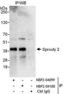 Immunoprecipitation: SPRY2 Antibody [NBP2-04099] - Samples: Whole cell lysate (1 mg for IP, 20% of IP loaded) from 293T cells. Antibodies: Affinity purified rabbit anti-Sprouty 2 antibody NBP2-04099 used for IP at 6 ug/mg lysate. Sprouty 2 was also immunoprecipitated by rabbit anti-Sprouty 2 antibody NBP2-04100, which recognizes a downstream epitope. For blotting immunoprecipitated Sprouty 2, NBP2-04100 was used at 1 ug/ml. Detection: Chemiluminescence with an exposure time of 30 seconds.