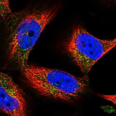 Immunocytochemistry/ Immunofluorescence SPRYD7 Antibody