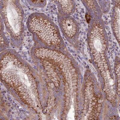 Immunohistochemistry-Paraffin SPRYD7 Antibody