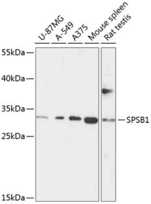 Western Blot: SPSB1 Antibody [NBP2-94732] - Analysis of extracts of various cell lines, using SPSB1 at 1:1000 dilution. Secondary antibody: HRP Goat Anti-Rabbit IgG (H+L) at 1:10000 dilution. Lysates/proteins: 25ug per lane. Blocking buffer: 3% nonfat dry milk in TBST. Detection: ECL Basic Kit . Exposure time: 30s.