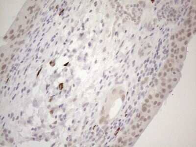 Immunohistochemistry: SPT3 Antibody (OTI1A5) - Azide and BSA Free [NBP2-74348] - Analysis of Human bladder tissue. (Heat-induced epitope retrieval by 1mM EDTA in 10mM Tris buffer (pH8.5) at 120C for 3 min)