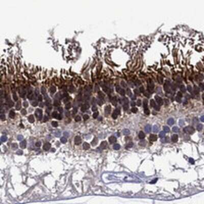 Immunohistochemistry-Paraffin: SPTBN5 Antibody [NBP3-17175] - Staining of human retina shows strong cytoplasmic and nuclear positivity in photoreceptor and inner nuclear layers.
