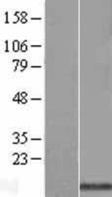Western Blot: SPTSSA Overexpression Lysate (Adult Normal) [NBL1-08178] Left-Empty vector transfected control cell lysate (HEK293 cell lysate); Right -Over-expression Lysate for SPTSSA.
