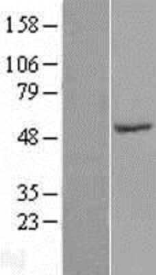 Western Blot: SPZ1 Overexpression Lysate (Adult Normal) [NBL1-16443] Left-Empty vector transfected control cell lysate (HEK293 cell lysate); Right -Over-expression Lysate for SPZ1.