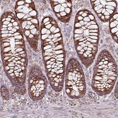 Immunohistochemistry-Paraffin: SQRDL Antibody [NBP2-48742] - Staining of human rectum shows moderate granular cytoplasmic positivity in glandular cells.