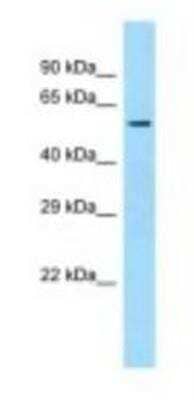 Western Blot: SQRDL Antibody [NBP1-98431] - Mouse Liver Lysate 1.0ug/ml, Gel Concentration: 12%