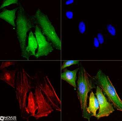 Immunocytochemistry/Immunofluorescence: SR-BI/SR-BII Antibody [NB400-134] - SR-BI/SR-BII antibody was tested in HeLa cells with DyLight 488 (green). Nuclei and alpha-tubulin were counterstained with DAPI (blue) and Dylight 550 (red). 