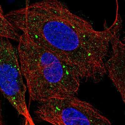 Immunocytochemistry/Immunofluorescence: SR-BI Antibody [NBP2-54750] - Immunofluorescent staining of human cell line U-2 OS shows localization to vesicles.