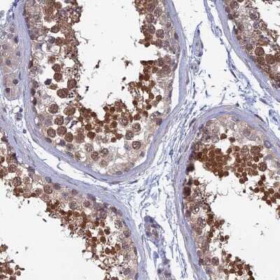 Immunohistochemistry-Paraffin: SRA1 Antibody [NBP2-48816] - Staining of human testis shows strong cytoplasmic and nuclear positivity in cells in seminiferous ducts.