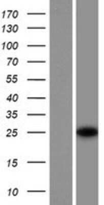 Western Blot: SRA1 Overexpression Lysate (Adult Normal) [NBP2-08584] Left-Empty vector transfected control cell lysate (HEK293 cell lysate); Right -Over-expression Lysate for SRA1.