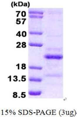 SDS-Page: SRA1 Protein [NBP2-22832]