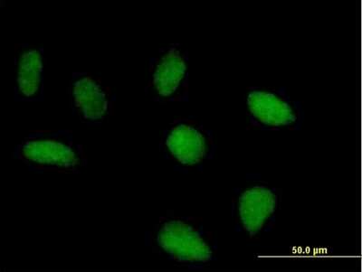 Immunocytochemistry/Immunofluorescence: SRBD1 Antibody [H00055133-B01P] - Analysis of purified antibody to FLJ10379 on HeLa cell. (antibody concentration 10 ug/ml)