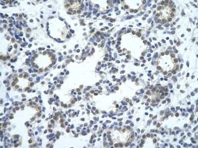 Immunohistochemistry: SRBD1 Antibody [NBP1-57557] - Human Lung cell Cellular data: alveolar cell Antibody Concentration: 4.0-8.0 ug/ml Magnification: 400X.