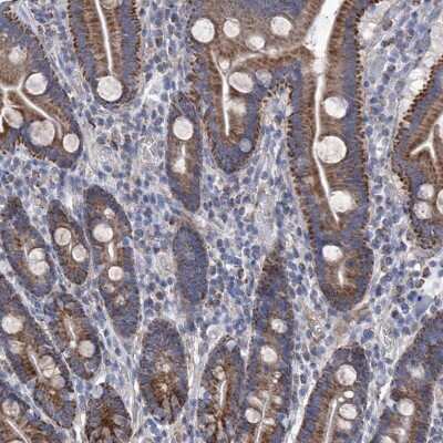 Immunohistochemistry-Paraffin SRBD1 Antibody