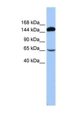 Western Blot: SRBD1 Antibody [NBP1-57557] - 721_B cell lysate, concentration 0.2-1 ug/ml.