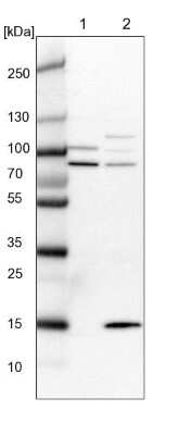 Western Blot SRBD1 Antibody