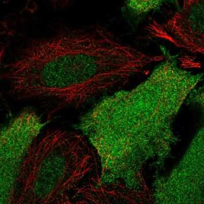 Immunocytochemistry/Immunofluorescence: SRC1 Antibody [NBP2-55919] - Staining of human cell line SiHa shows localization to nucleoplasm, plasma membrane & cytosol.