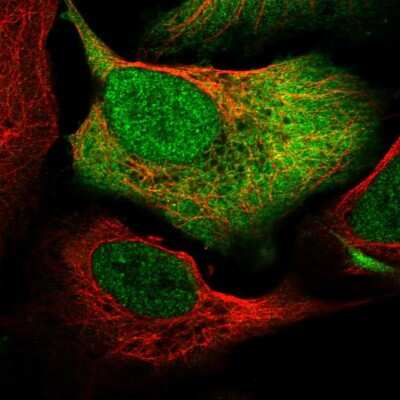 Immunocytochemistry/Immunofluorescence: SRC1 Antibody [NBP2-57610] - Staining of human cell line U-2 OS shows localization to nucleoplasm, plasma membrane & cytosol.