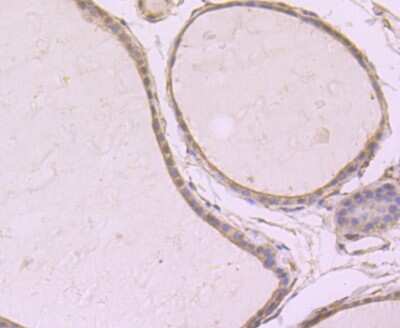 Immunohistochemistry-Paraffin: SRC1 Antibody (JB66-31) [NBP2-75672] - Analysis of paraffin-embedded human thyroid gland tissue using anti-SRC1 antibody. Counter stained with hematoxylin.