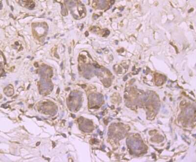 Immunohistochemistry-Paraffin: SRC1 Antibody (JB66-31) [NBP2-75672] - Analysis of paraffin-embedded human breast tissue using anti- SRC1 antibody. Counter stained with hematoxylin.