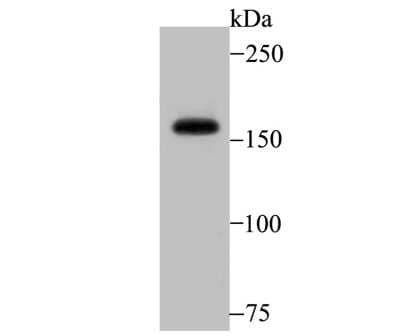 Western Blot: SRC1 Antibody (JB66-31) [NBP2-75672] - Analysis of SRC1 on K562 cell lysate using anti- SRC1 antibody at 1:2000 dilution.
