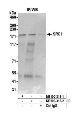 Immunoprecipitation: SRC1 Antibody [NB100-313] - Detection of human SRC1 by western blot of immunoprecipitates. Samples: Whole cell lysate (0.5 or 1.0 mg per IP reaction; 20% of IP loaded) from HEK293T cells prepared using NETN lysis buffer. Antibodies: Affinity purified rabbit anti-SRC1 antibodyNB100-313 (lot NB100-313-2) used for IP at 6 ug per reaction. SRC1 was also immunoprecipitated by a previous lot of this antibody (lot NB100-313-1). For blotting immunoprecipitated SRC1, NB100-313 was used at 0.4 ug/ml. Detection: Chemiluminescence with an exposure time of 30 seconds.