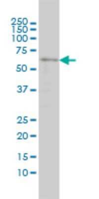 Western Blot: SRCRB4D Antibody (3D9) [H00136853-M01] - SRCRB4D monoclonal antibody (M01), clone 3D9 Analysis of SRCRB4D expression in C32.