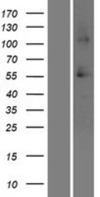 Western Blot SRCRB4D Overexpression Lysate