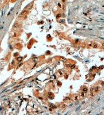 Immunohistochemistry-Paraffin SRD5A1 Antibody