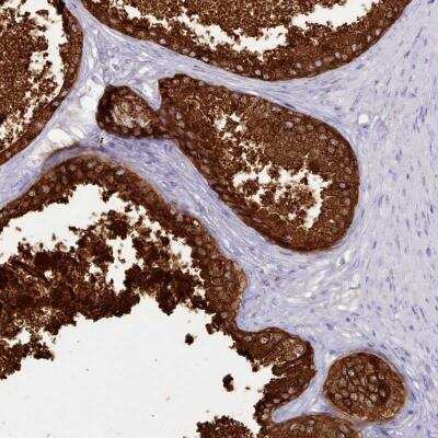 Immunohistochemistry-Paraffin: SRD5A1 Antibody [NBP2-31909] - Staining of human prostate shows strong cytoplasmic positivity in glandular cells.