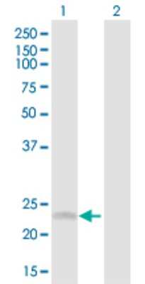 Western Blot: SRD5A1 Antibody [H00006715-D01P] - Analysis of SRD5A1 expression in transfected 293T cell line by SRD5A1 polyclonal antibody.Lane 1: SRD5A1 transfected lysate(29.50 KDa).Lane 2: Non-transfected lysate.