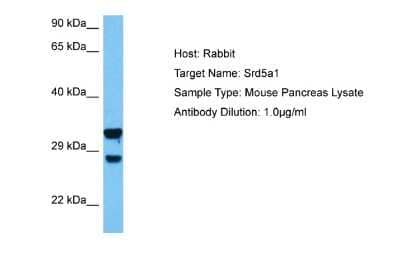 Western Blot: SRD5A1 Antibody [NBP2-88362] - Host: Mouse. Target Name: SRD5A1. Sample Tissue: Mouse Pancreas. Antibody Dilution: 1ug/ml