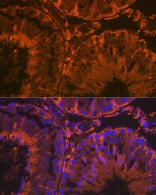 Immunohistochemistry: SRD5A2 Antibody (8A4H5) [NBP3-15900] - Immunofluorescence analysis of rat testis using SRD5A2 Rabbit mAb (NBP3-15900) at dilution of 1:100 (40x lens). Blue: DAPI for nuclear staining.