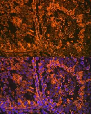 Immunohistochemistry: SRD5A2 Antibody (8A4H5) [NBP3-15900] - Immunofluorescence analysis of mouse testis using SRD5A2 Rabbit mAb (NBP3-15900) at dilution of 1:100 (40x lens). Blue: DAPI for nuclear staining.