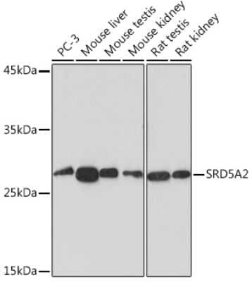 Western Blot: SRD5A2 Antibody (8A4H5) [NBP3-15900] - Analysis of extracts of various cell lines, using SRD5A2 Rabbit mAb (NBP3-15900) at 1:1000 dilution. Secondary antibody: HRP Goat Anti-Rabbit IgG (H+L) at 1:10000 dilution. Lysates/proteins: 25ug per lane. Blocking buffer: 3% nonfat dry milk in TBST. Detection: ECL Basic Kit. Exposure time: 180s.