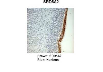 Immunohistochemistry: SRD5A2 Antibody [NBP1-69492] - Monkey adrenal gland Primary Antibody Dilution: 1 : 25 Secondary Antibody: Anti-rabbit-HRP Secondary Antibody Dilution: 1 : 1000 Color/Signal Descriptions: Brown: SRD5A2 Blue: Nucleus Gene name: SRD5A2 Submitted by: Jonathan Bertin, Endoceutics Inc.