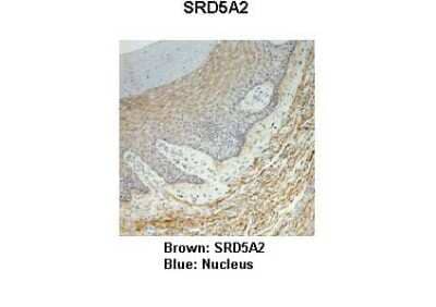 Immunohistochemistry: SRD5A2 Antibody [NBP1-69492] - Monkey vagina Primary Antibody Dilution: 1 : 25 Secondary Antibody: Anti-rabbit-HRP Secondary Antibody Dilution: 1 : 1000 Color/Signal Descriptions: Brown: SRD5A2 Blue: Nucleus Gene name: SRD5A2 Submitted by: Jonathan Bertin, Endoceutics Inc.