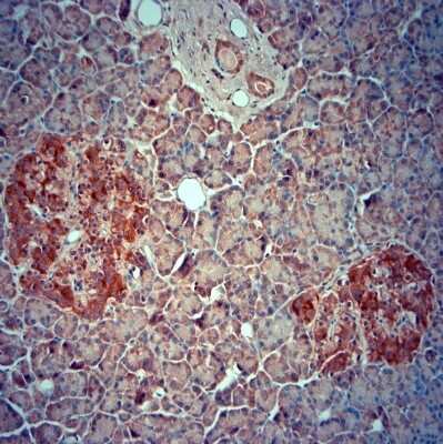 Immunohistochemistry-Paraffin SRD5A2 Antibody