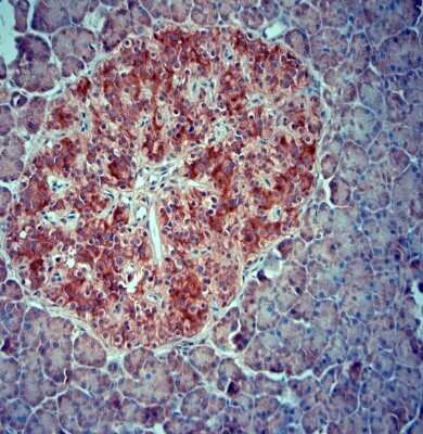 Immunohistochemistry-Paraffin SRD5A2 Antibody